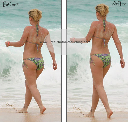 Retouching for figure correction and cosmetic limb lengthening