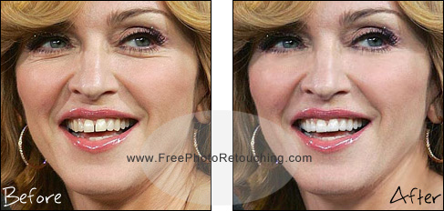 Close tooth gap with photo editing